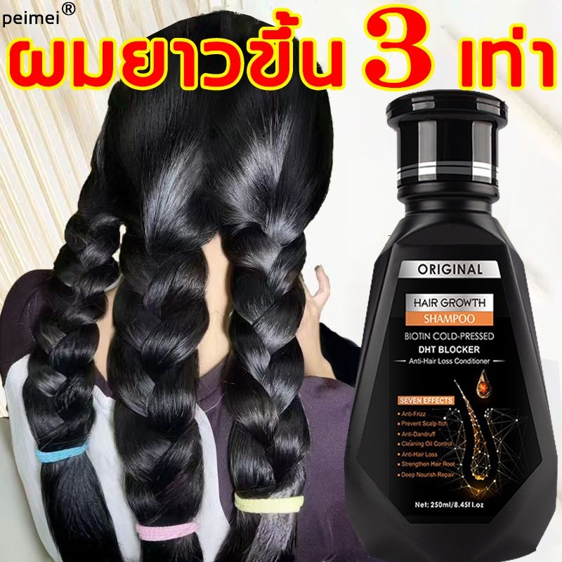 ป้องกันหัวล้าน สกัดจากขิงสด สูตรน้ำขิง ปลูกผมอย่างอ่อนโยน บำรุงรากผม แชมพูขิงเพียว แชมพูลดผมร่วง ยาสระผมเร่งยาว