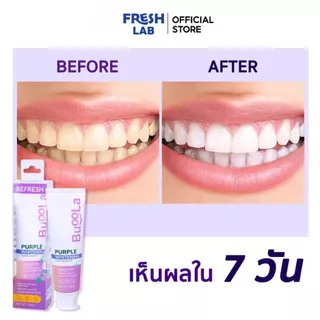 [ ยอดขายสูงสุด ]BUOOLA ยาสีฟัน เพอร์เพิล ไวท์ ช่วยให้ฟันขาวขึ้น ลดคราบฟันเหลือง เนื้อเจลสีม่วง แถมฟรีแปรงพรีเมี่ยม1ชิ้น
