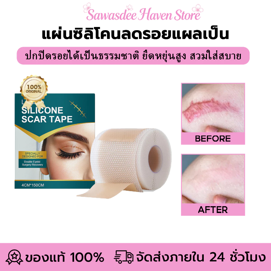 Laniska แผ่นแผลเป็นซิลิโคน แผ่นแปะลดรอยแผลเป็นนูน ลดรอยแผลเป็นนูน แผลคีลอยด์ คีลอยด์สิว