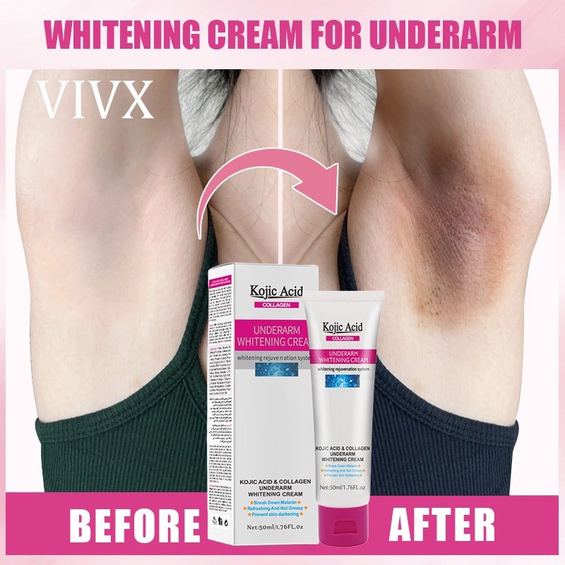 VIVX Kojic Acid ครีมขาหนีบดำ 50ml ครีมทารักแร้ขาว ครีมบำรุงรักแร้ เข่าดำ ผิวขาว สิ่งประดิษฐ์ ครีมขาห