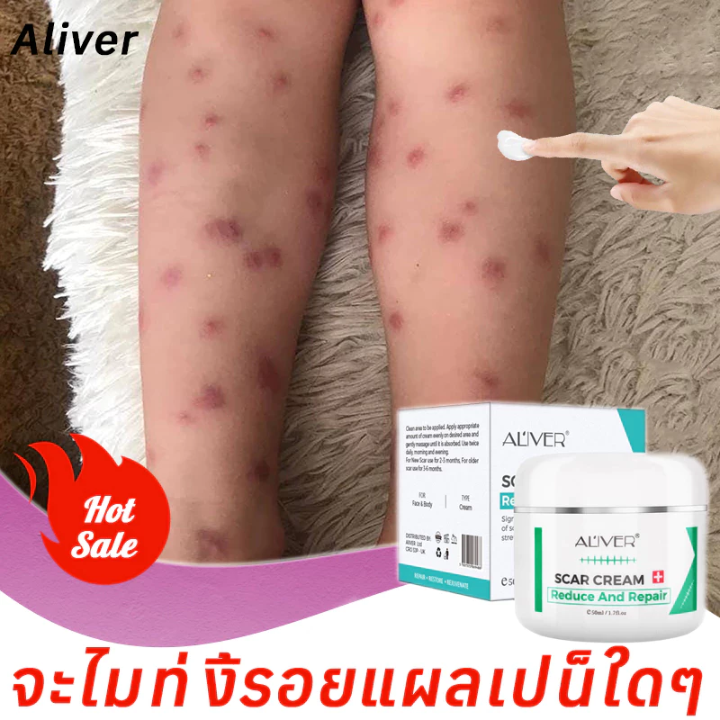[ของแท้ 100%] ALIVER ครีมลดรอยแผลเป็น แผลเป็นนูนหนา แผลเป็นถลอก เร่งการซ่อมแซมให้ผิว ครีมแผลเป็น ลดแผลเป็น ยาทาแผลเป็น