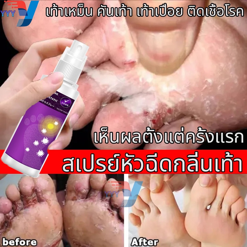 【ของแท้100%】☞ครีมลดกลิ่นเท้า ครีมทาเท้า ช่วยบรรเทาปัญหาเท้าลอกและมีกลิ่นได้อย่างรวดเร็ว (ดับกลิ่นเท้า,สเปย์ด