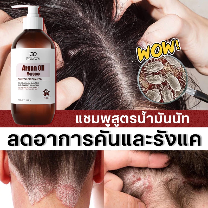 แชมพูรังแค ยาสระผมขจัดรังแค แชมพูยาเชื้อรา 500ml ซ่อมแซมผมชี้ฟูเสียหาย บรรเทาอาการคันหนังศีรษะ  ขจัดรังแค ลดผมร่วง