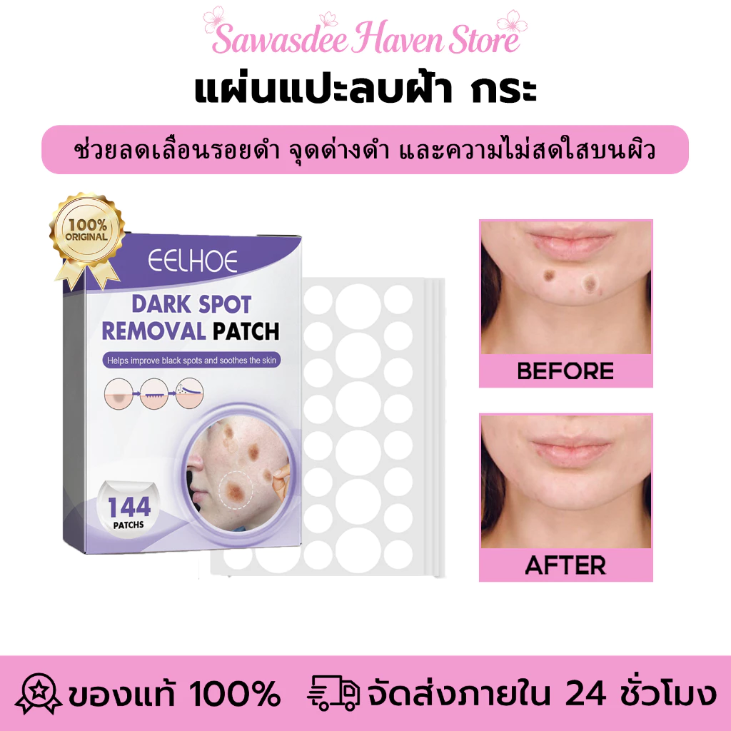 EELHOE แผ่นแปะลบฝ้า กระ แผ่นแปะลบรอยด่างดำ ช่วยลดรอยด่างดำ รอยหมองคล้ำและผิวที่มีเม็ดสีมากเกินไป