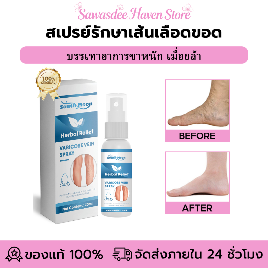 South Moon สเปรย์รักษาเส้นเลือดขอด ช่วยลดอาการตึง บรรเทาอาการปวดและบวม และทำให้ขาของคุณรู้สึกเบาขึ้น