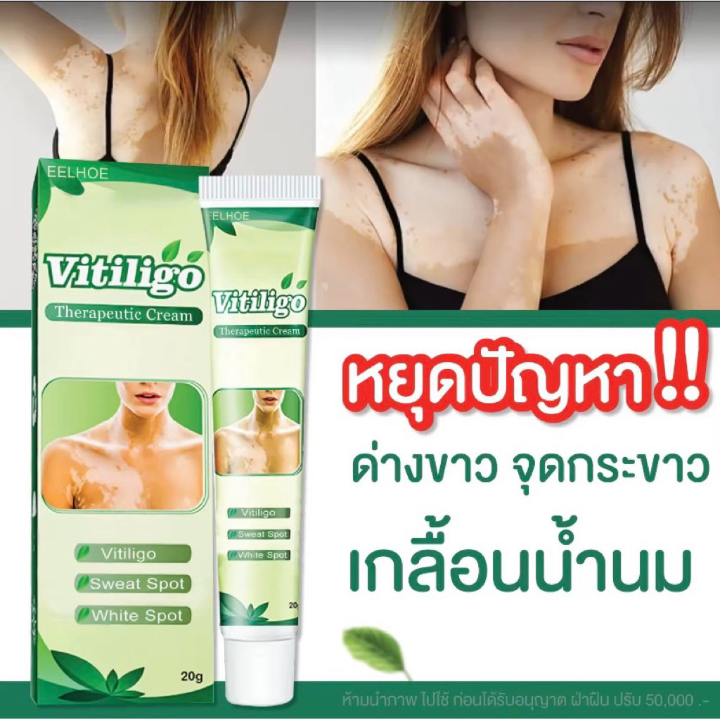 Vitiligo cream ขนาด 20 กรัม ผิวด่างขาว กระขาว กระแดด สินค้าพร้อมส่งในไทย