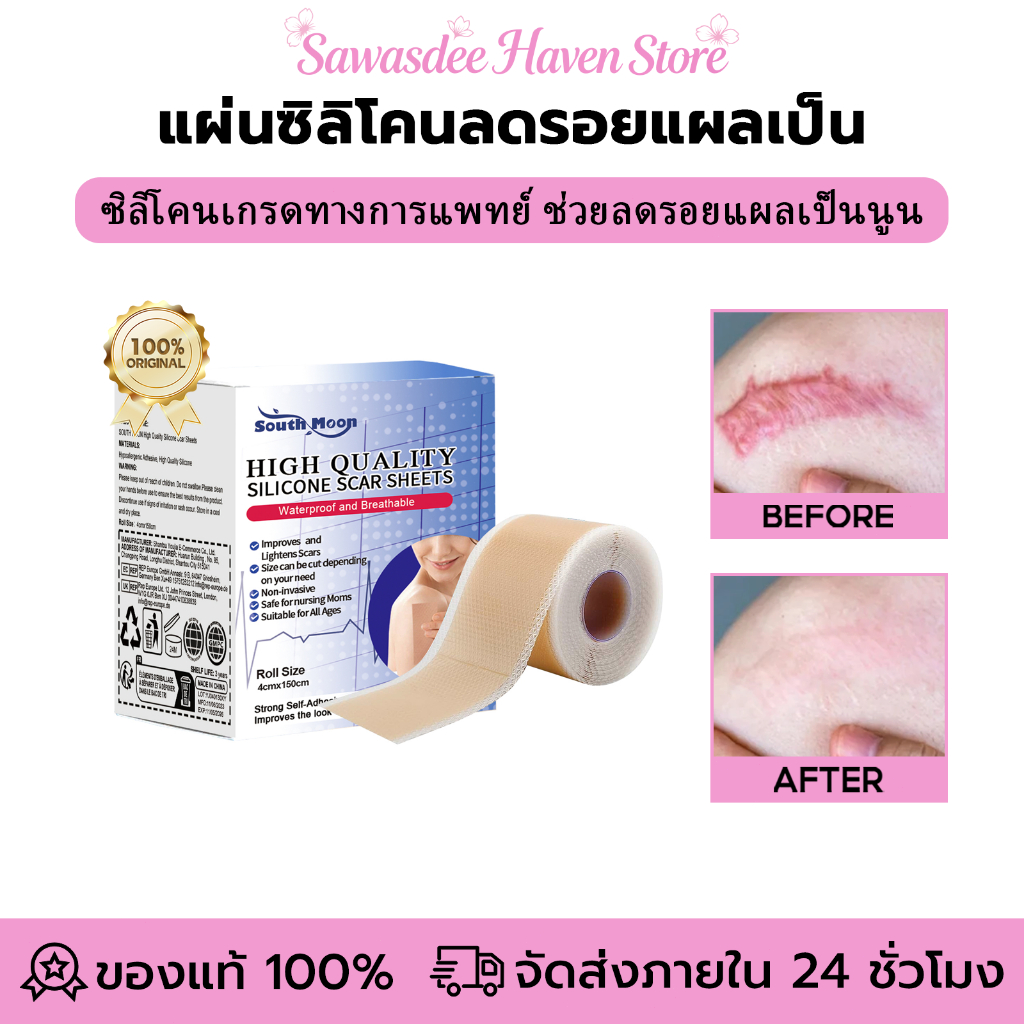 South Moon รักษารอยแผลเป็น แผ่นแปะแผลเป็น กําจัดรอยแผลเป็นจากแผลเป็น เทปเจลแผลเป็นไหม้  ลดรอยแผลเป็น