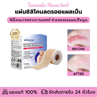 South Moon รักษารอยแผลเป็น แผ่นแปะแผลเป็น กําจัดรอยแผลเป็นจากแผลเป็น เทปเจลแผลเป็นไหม้ ลดรอยแผลเป็นนูนแดง