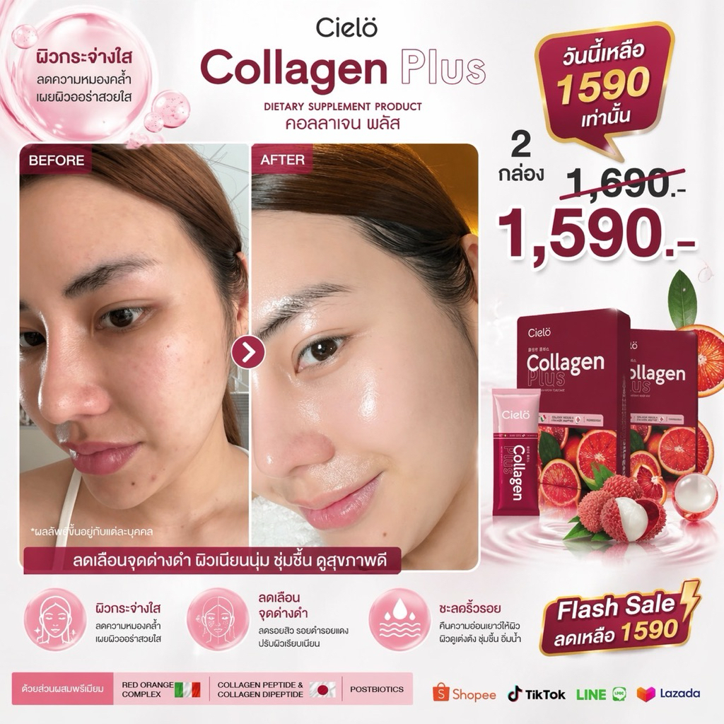 เซียโล่ คอลลาเจน พลัส Cielo Collagen Plus+ (2กล่อง/20แคปซูล) มีวิตามิน C,B8 ดูแลผิว ผมร่วงน้อย PCOS 