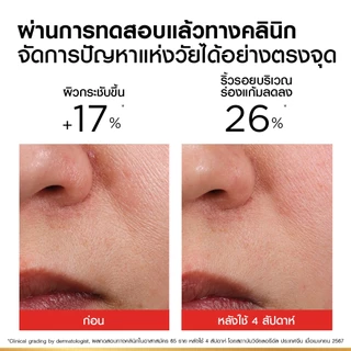 ลอรีอัล ปารีส L’Oréal Paris Revitalift Clinical Grade Advanced Anti-Wrinkle Firming Day Cream 50ml เดย์ครีม ลดริ้วรอย