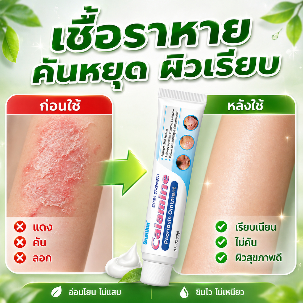 [ต้านเชื้อรา] ครีมแก้ผื่นคัน บรรเทาอาการคัน รอยแดง และผิวลอก สูตรอ่อนโยน ซึมง่าย ใช้ได้กับหลายบริเวณ เช่น แขน ขา และเท้