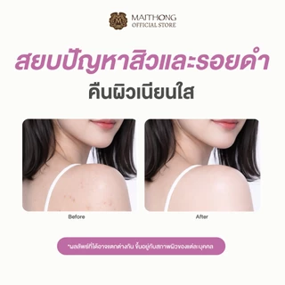 [เซ็ตสุดคุ้ม แพ็ค3] Maithong ไหมทอง สบู่ใส มังคุด 70g สูตรดูแลปัญหาสิว ลดรอยดำ ฟื้นฟูผิวให้เนียนใส แถมถุงตีฟอง