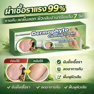 ครีมทาสังคัง สะเก็ดเงินครีม ครีมบำรุงผิว 20g รอยแดง โรคผิวหนัง เกลื้อน กลาก คัน สมุนไพร แก้คันเรื้อรัง คันในร่มผ้า