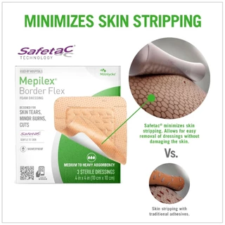Mepilex Border Flex แผ่นปิดแผลโฟมและป้องกันแผลกดทับ ของแท้พร้อมส่ง EXP 2027+