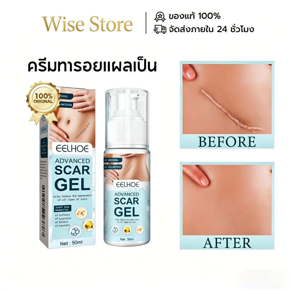 EELHOE ครีมทารอยแผลเป็น Scar Gel รักษารอยแผลเป็น แผลผ่าตัด ทาแผลเป็น ทาแผลเป็นนูน ครีมทาแผลเป็น ครีมลบแผลเป็น
