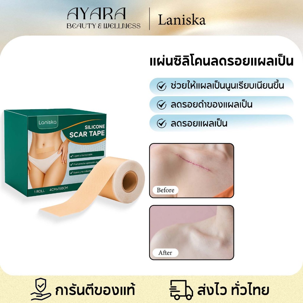EELHOE แผ่นซิลิโคน สำหรับลดรอยแผลเป็น แผ่นซิลิโคนลดรอยแผลเป็น ลดรอยแผลเป็น ขนาด 4x150 ซม.