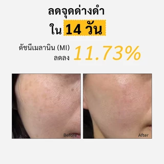 Spring Letter Toner Pad แผ่นเช็ดหน้า VC ขนาดพกพา ลดจุดด่างดำ ขาวใส ละลายฝ้า กระ ฝ้า จุดด่างดำ จางลง สำหรับผิวบอบบาง