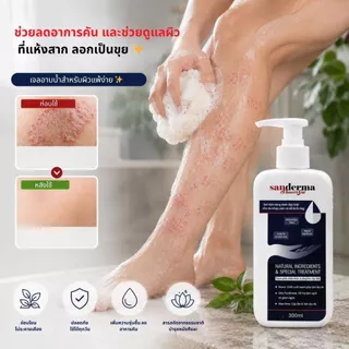 [Best Seller] เซตสบู่อาบน้ำ Sanderma 300 มล. 2 ขวด – เหมาะสำหรับผิวขนคุดและสิวหลัง