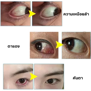 น้ำตาเทียม อ่อนโยน สูตรสมุนไพร ให้ความชุ่มชื้น ตาไม่แห้ง ใช้งานสะดวก ทุกวัน ปลอดภัย ไม่ระคายเคือง
