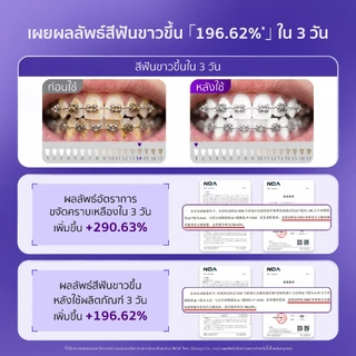 EHD ยาสีฟันฟันขาว ลดคราบเหลือง 3 วัน ฟันขาวขึ้น +196% สูตรไวโอเล็ตแก้สี ฟลูออไรด์ 1000ppm ป้องกันฟันผุ ลดกลิ่นปาก 24 ชม.