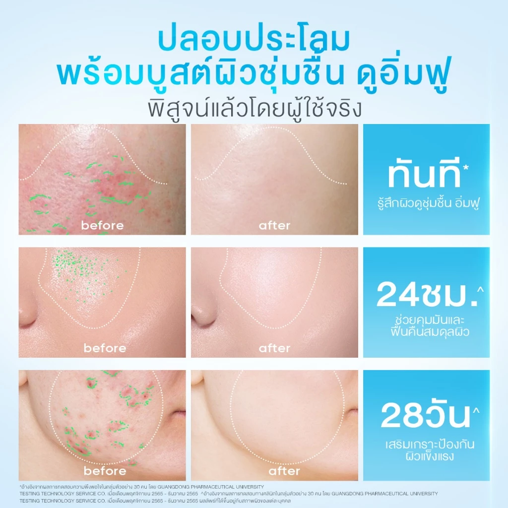 [NO.1]SKINTIFIC 5X Ceramide Barrier Moisturizer Gel มอยเจอร์ไรเซอร์ ครีมทาหน้า ฟื้นบำรุงเกราะป้องกันผิว ปลอบประโลมรอยแดง thumbnail 4
