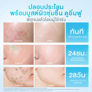 SKINTIFIC 5X Ceramide Barrier Moisturizer Gel บาล์มฟื้นบำรุงผิว ช่วยปลอบประโลม ฟื้นบำรุงผิว มอยส์เจอร์ไรเซอ