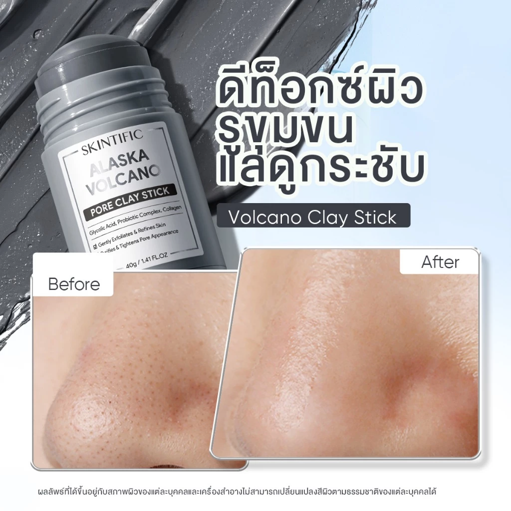 SKINTIFIC Clay Mask Stick Mugwort สคินทิฟฟิค มัควอร์ธ แอคเน่ เคลย์ สติ้กซ์  มาร์คหน้า มาร์คโคลน ลดสิวหน้าใส ลด สิวเสี้ยน thumbnail 8