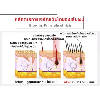 น้ำยาปลูกหนวดคิ้ว 30ml เห็นผลภายใน 7 วัน เร่งขนเติบโต