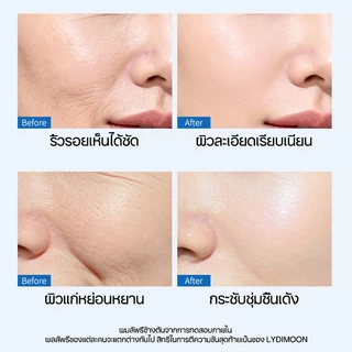 แผ่นแปะร่องแก้มลึก แผ่นมาร์คร่องแก้ม ลดริ้วรอยร่องแก้ม กระชับยกกระชับ ลบร่องลึก หน้าเด้งเรียบเนียน เทปยกกระชับผิว