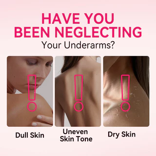 โทนเนอร์เช็ดรักแร้ ไอบลองก์ ขาหนีบ คอดำ ข้อศอกดดำ Iblanc Underarm Toning ขนาด 200 ml.