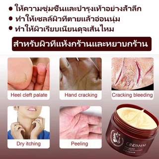 ครีมทาส้นทาแตก ครีมทาเท้าแตก ที่ขัดเท้าแตก ครีมบำรุงเท้า เท้าแตก ดูแลมือ ขัดผิวหนัง แห้ง หยาบ หนัง