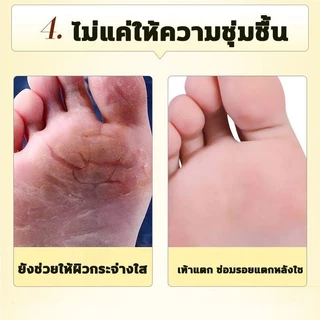 ครีมน้ำมันม้าฟื้นฟูผิวมือเท้า 30กรัม แก้ปัญหาผิวแห้งกร้าน ลดผิวด้านดำ ผิวเนียนนุ่มขาว