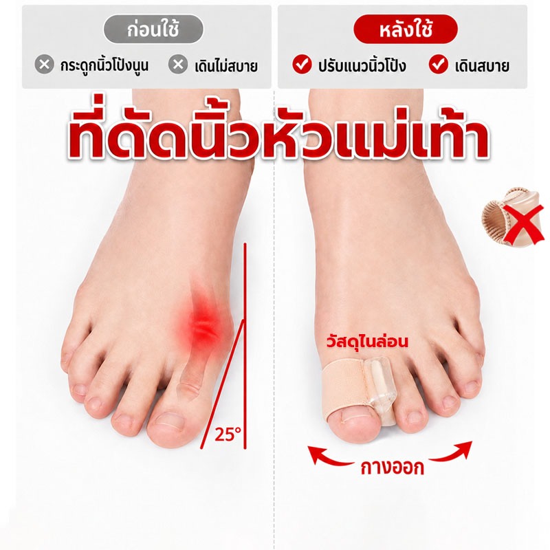 ซิลิโคนคั่นนิ้วก้อยเท้า ลดการเกเอียงของนิ้วก้อยเท้า มีรองข้าง กันกัดเท้า
