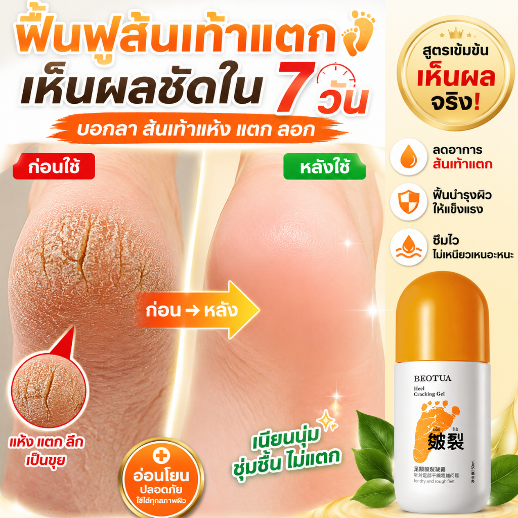 ครีมทาเท้า ครีมบำรุงส้นเท้า ช่วยเพิ่มความชุ่มชื้น ลดความแห้งกร้าน ทำให้ผิวเท้านุ่มขึ้น เหมาะสำหรับดูแลเท้าเป็นประจำ