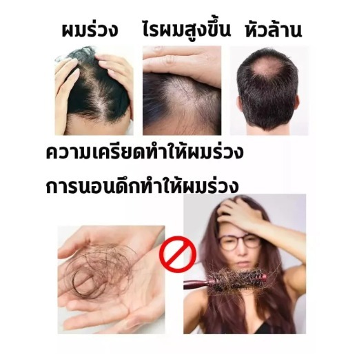 แชมพูสมุนไพรธรรมชาติของแท้ 500ml ทำความสะอาดหนังศีรษะลึก รูปที่ 5