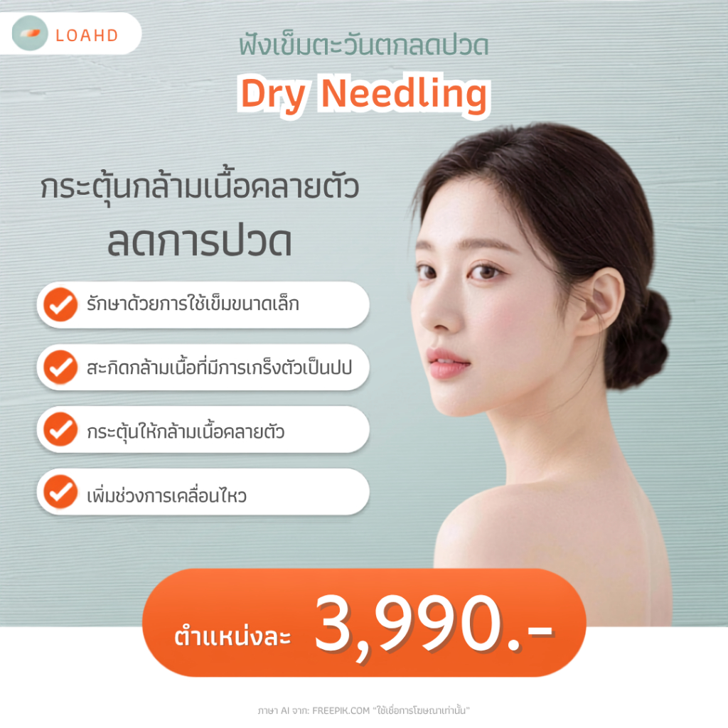 Dry Needling ฝังเข็มตะวันตกลดปวด *กรุณาติดต่อทางแชทเพื่อสำรองคิวก่อนทำการสั่งซื้อทุกครั้ง