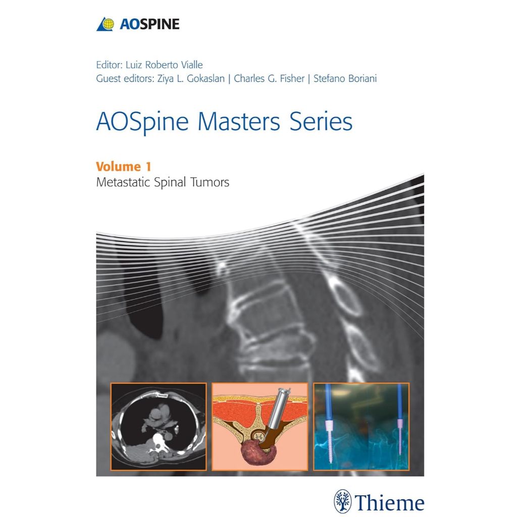 หนังสือ AOSpine Masters Series Volume 1: Metastatic Spinal Tumors ed 1/2015