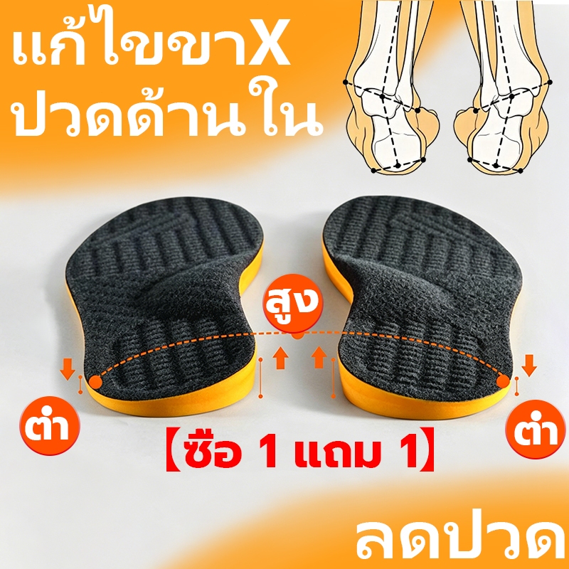 แผ่นรองเท้ารองรับอุ้งเท้า ขาเอ็กซ์/เท้าเอียงนอก/ขาเป็ดแปะ/ส้นในสึก บรรเทาอาการปวด