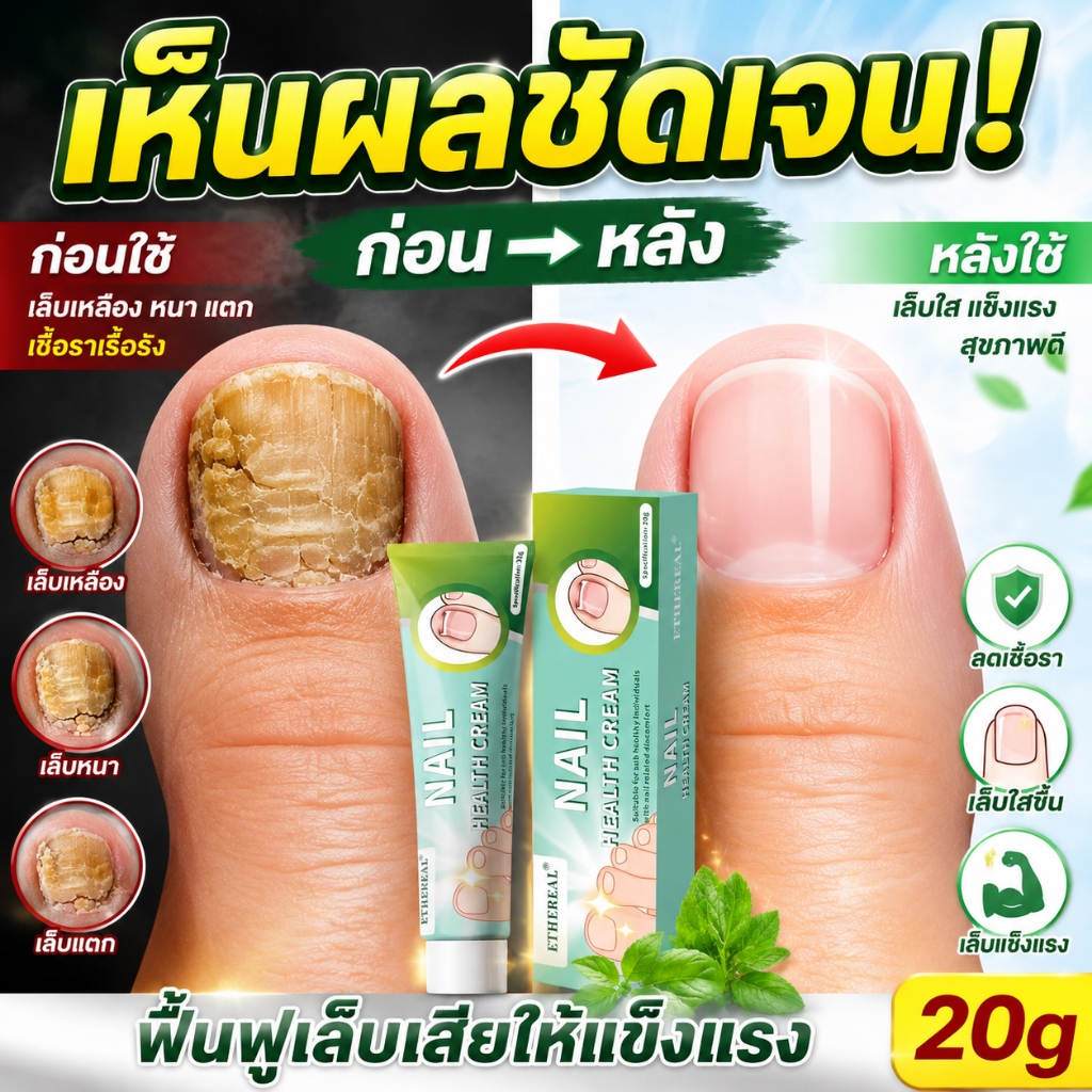 เห็นผลภายใน7วัน เซรั่มบำรุงเล็บ ครีมซ่อมเล็บ ช่วยให้เล็บกลับมาแข็งแรง ครีมบำรุงเล็บ ยาเชื้อราเล็บ เซรั่มรักษาเล็บ 20g
