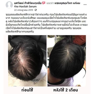 ฮาวิล่าห์ เจแปน โทนิคเสริมสร้างเส้นผมใหม่ ให้ผมดูหนามีวอลลุ่มขึ้น ขนาด 100 มล.