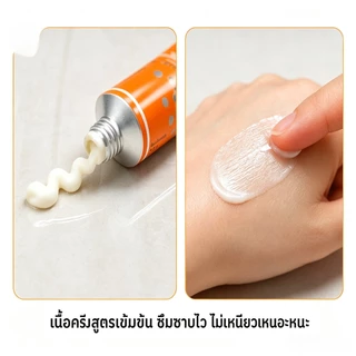 Azelaic Acid 20% Cream Blackhead Acne Scar Removal Sensitive Skin Hydrating Repair Gel