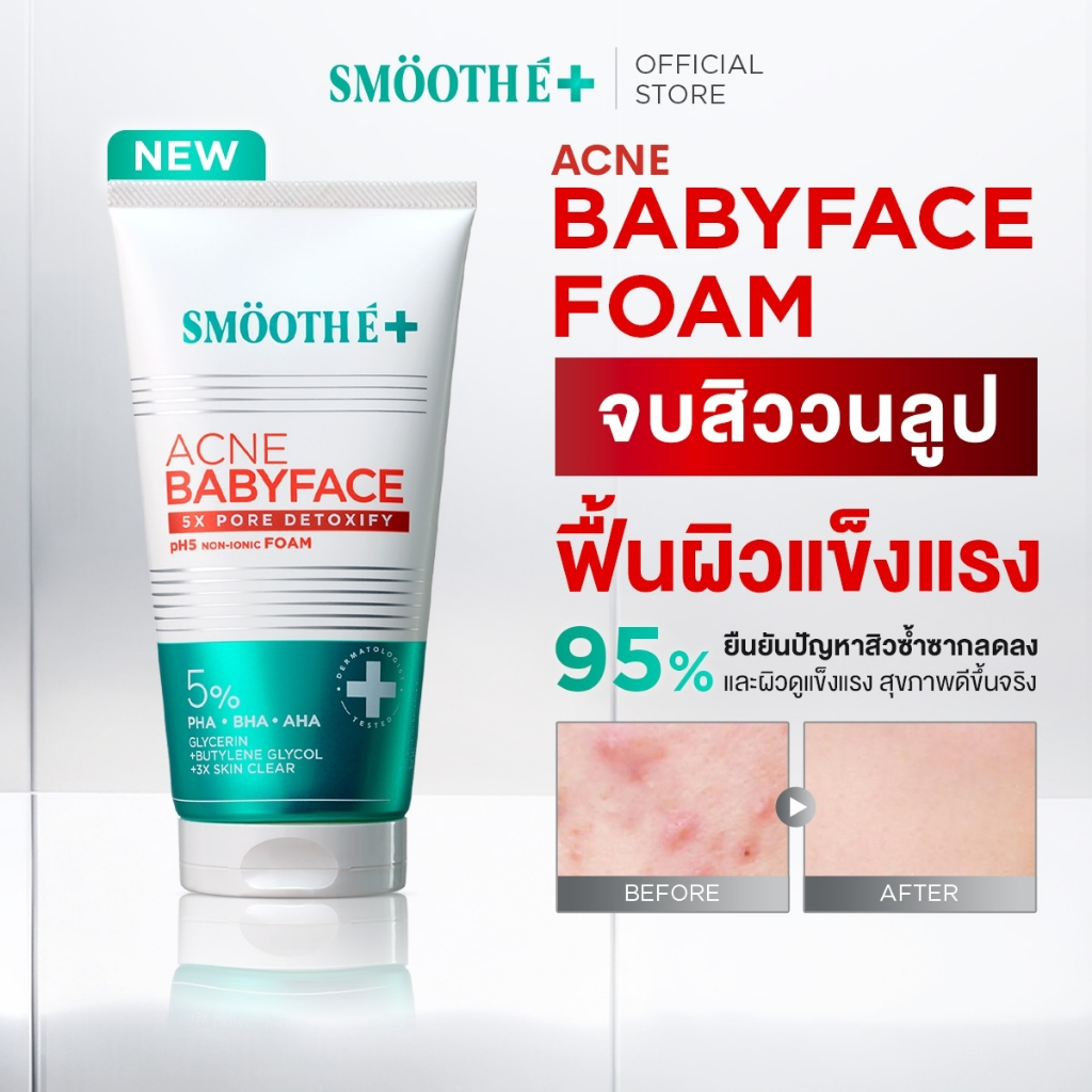 [ใหม่!] Smooth E Babyface Acne-5 Detoxify Non-Ionic Foam 40 