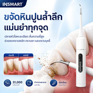 INSMART อัลตราโซนิกทำความสะอาดฟัน ล้างฟัน ขูดหินปูน ขจัดคราบเหลือง ปลอดภัยไม่ทำร้ายฟัน