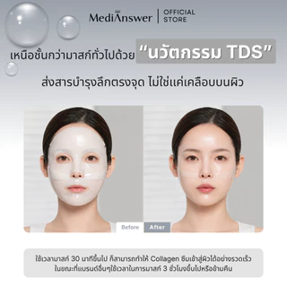 MEDIANSWER Collagen Mask | ไฮโดรเจลมาส์กคอลลาเจนแบบแผ่น (Sheet)