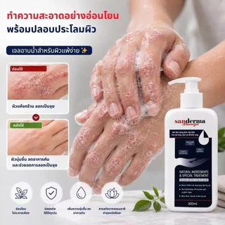 Sanderma เจลอาบน้ำ สูตรอ่อนโยน ฟื้นฟูผิวแพ้ง่าย ลดการอักเสบ ระคายเคืองและรอยแดง 300g