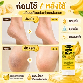 NAZAA บาล์มกล้วย ครีมทาส้นเท้าแตกของแท้ 20 กรัม ครีมทาเท้าแตก ครีมบำรุงเท้า ข้อศอก ผิวแห้งกร้าน Banana Balm