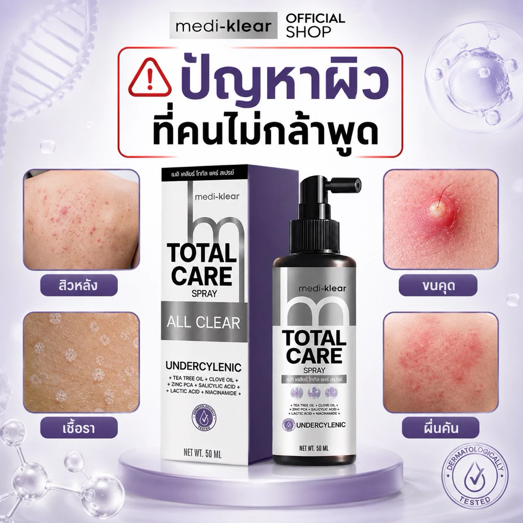 (เมดิเคลียร์) Medi-Klear สเปรย์สิวหลัง ขนคุด ผื่นคัน ผิวเชื้อรา Total Care Spray