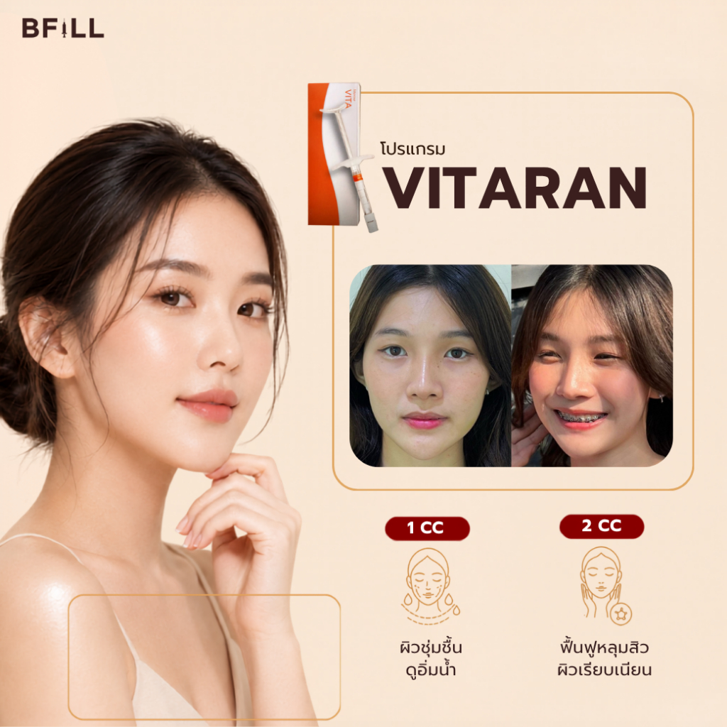 BFiLL โปรแกรม Vitaran PN skin booster “งานผิว” ให้ผิวดูแข็งแรง อิ่มน้ำ บีฟิล คลินิก