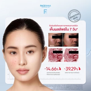 [NEW] [5%] B5 Niacinamide Bright Barrier Cream ล็อกความชุ่มชื้นให้ผิว ปลอบประโลมผิว ผิวดูกระจ่างใส