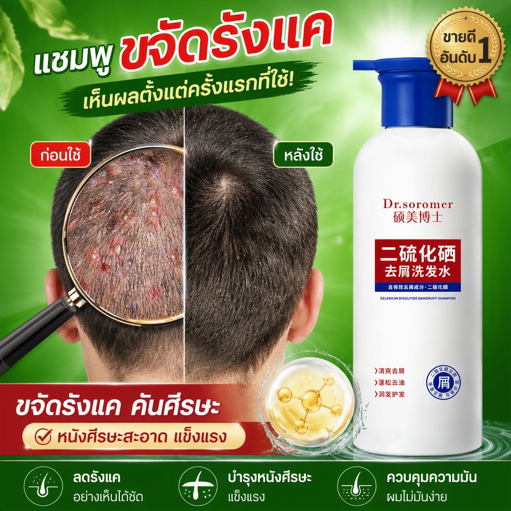แชมพูดูแลหนังศีรษะ 400ml ขจัดรังแค ต่อต้านเชื้อรา ควบคุมความมัน กำจัดไรฝุ่น